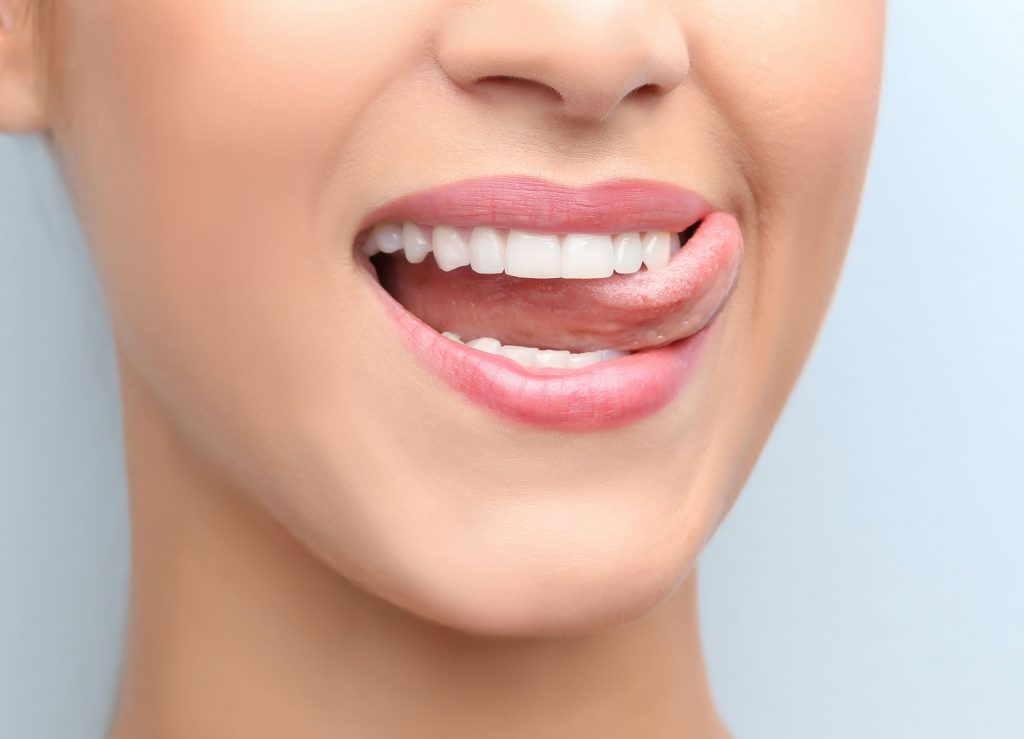composite veneers hull