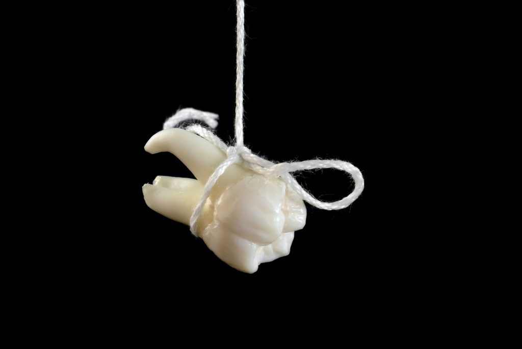 tooth extraction hull
