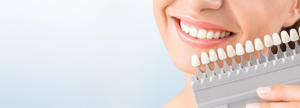 teeth whitening hull