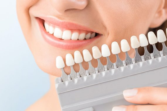 teeth whitening hull